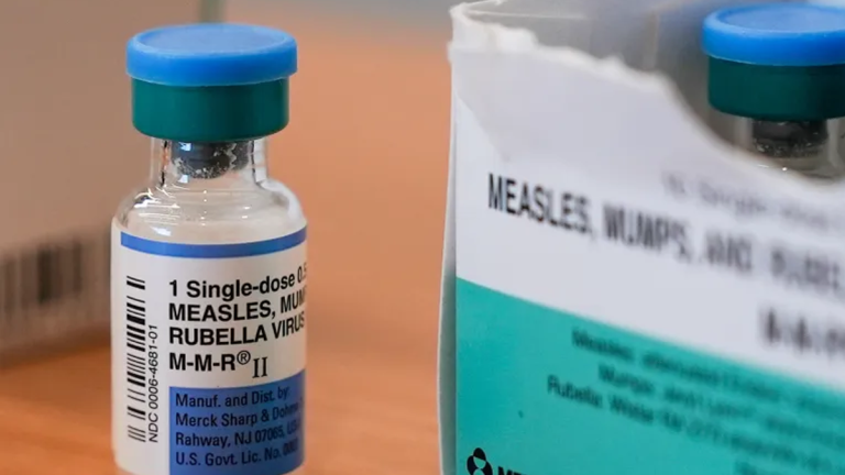 Measles